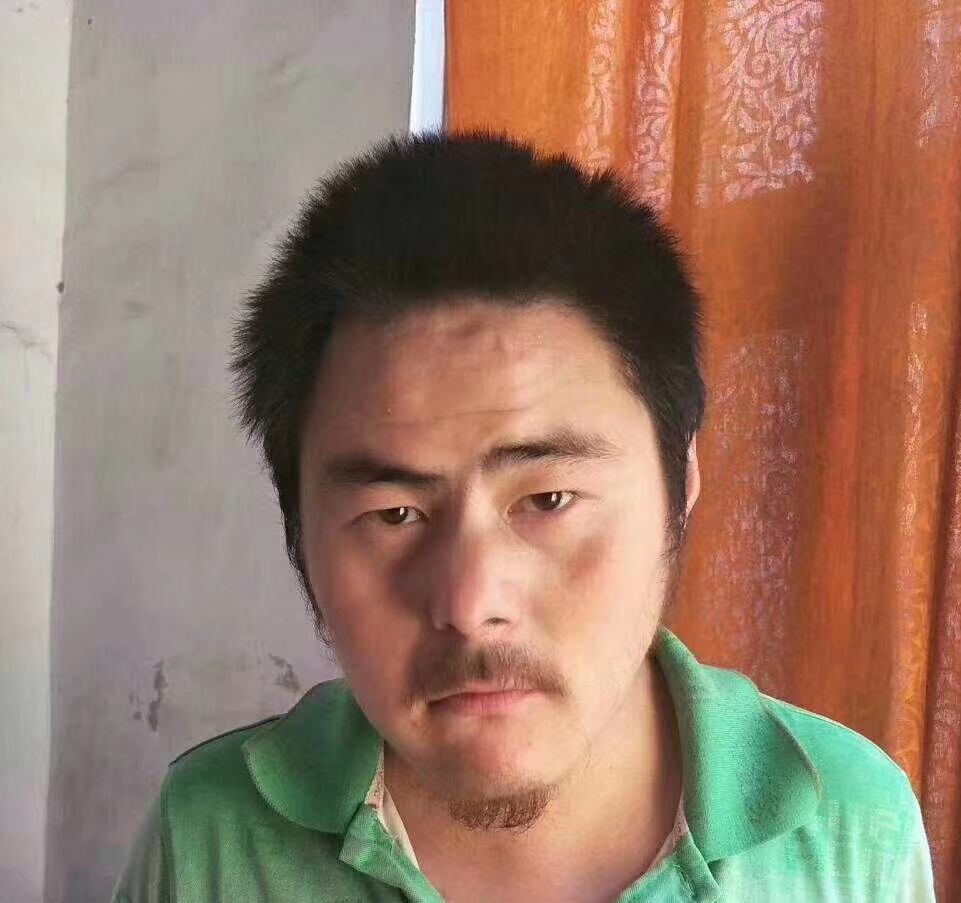 走失者照片 濮阳急寻：青年男子走失，患智力障碍...