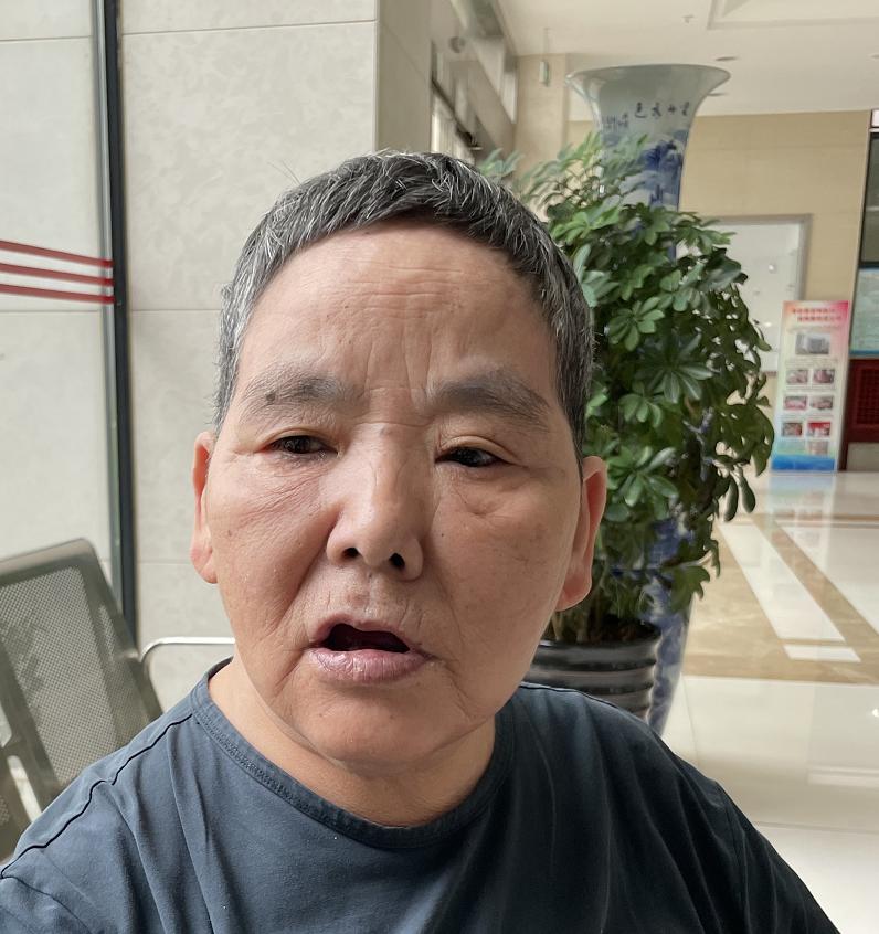 走失者照片 苏州常熟寻亲：七旬老太被救助多年，...