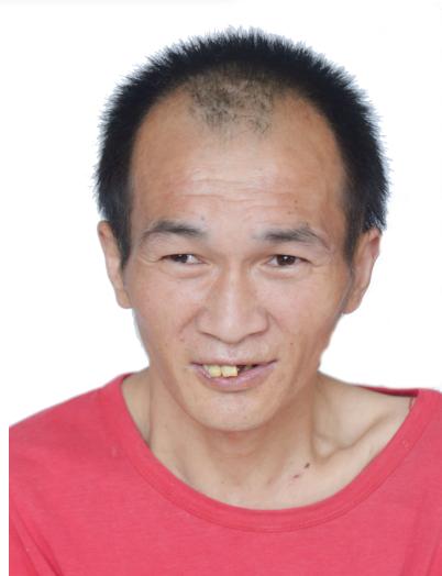走失者照片 衡水市救助管理站：青年男子被救助，...