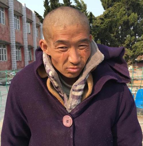 走失者照片 徐州寻亲：中年男子被救助，智力异常...