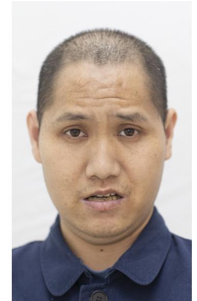 走失者照片 柳州寻亲：青年男子被救助，常胡言乱...