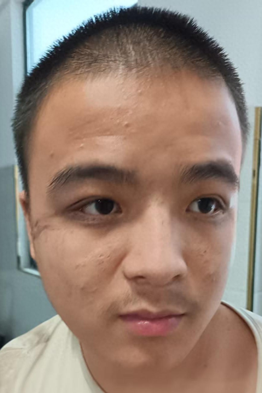 走失者照片 亳州市寻亲：青年男子被救助，穿白色...