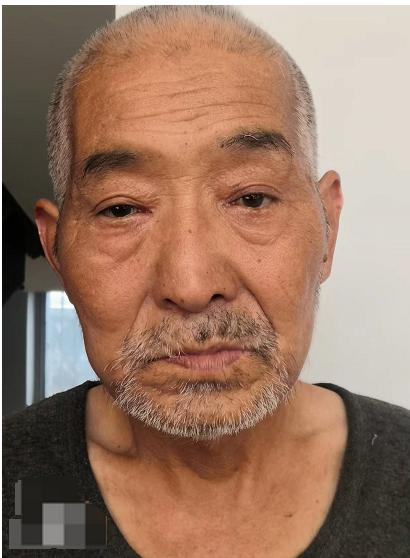走失者照片 西安寻亲：六旬老人被救助，自述叫王...
