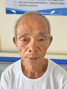走失者照片 六安寻亲：六旬聋哑老人被救助，右脸...