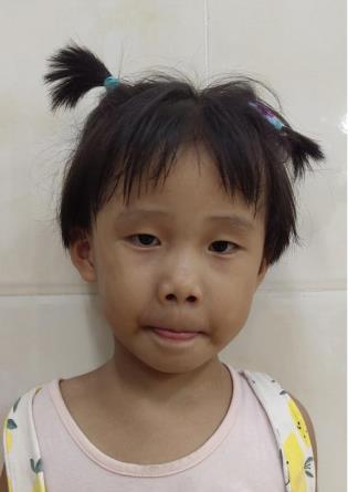 走失者照片 南宁寻亲：4岁女孩被救助多年，被发...