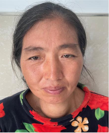 走失者照片 重庆寻亲：五旬女子被救助，穿黑底花...