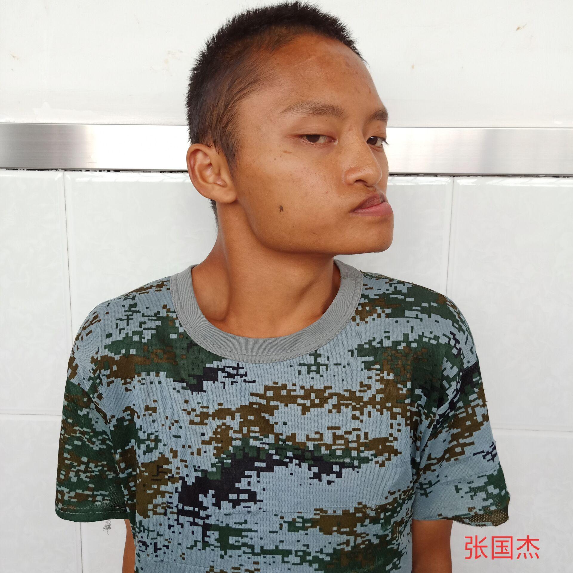 走失者照片 毕节寻亲：青年男子被救助，疑似智力...
