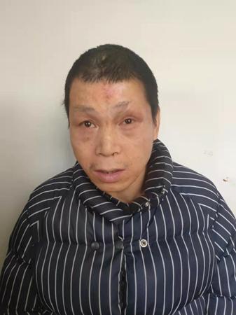 走失者照片 帮他回家！赣州中年男子被救助多年，...