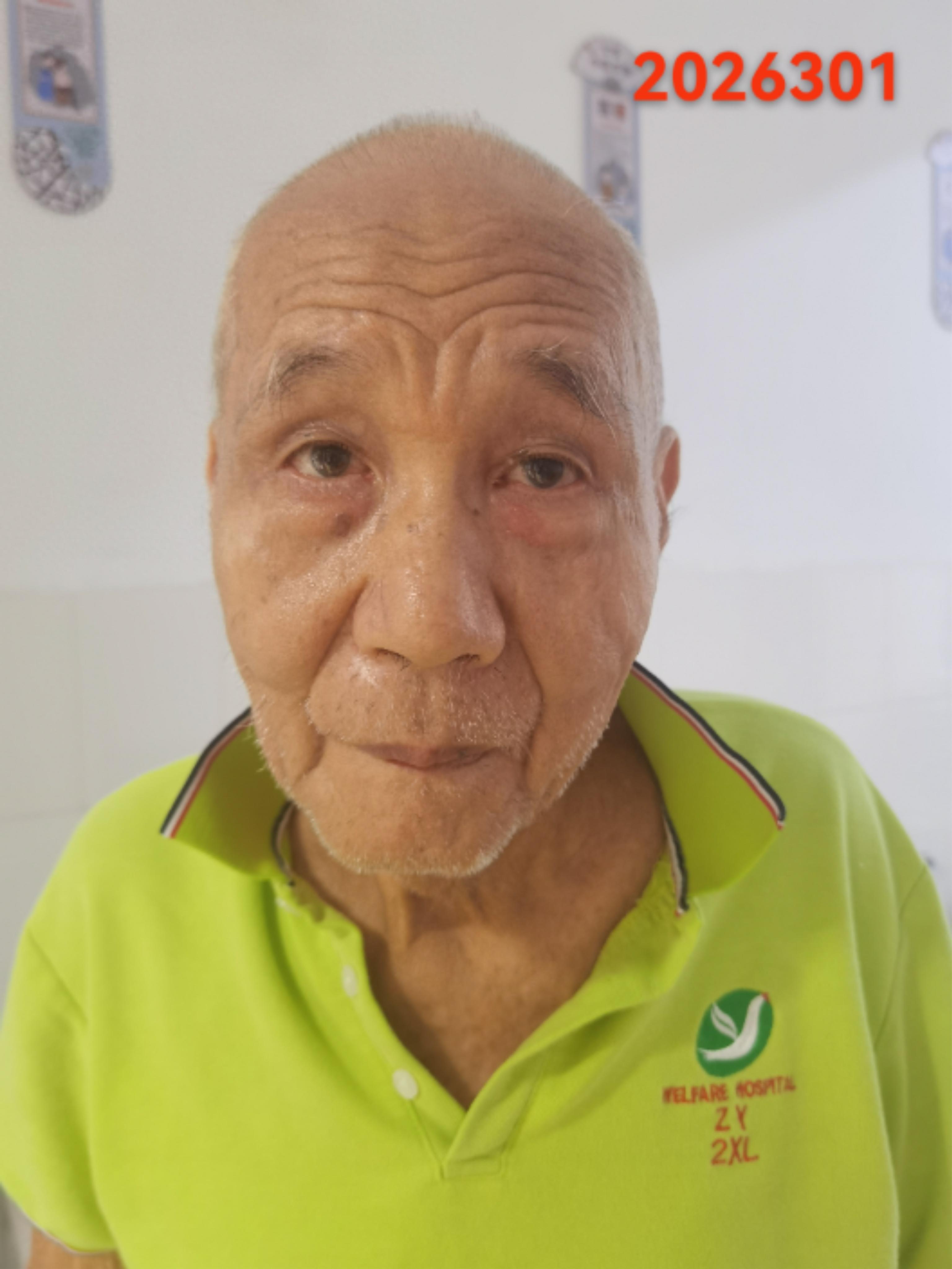 走失者照片 南宁市寻亲：八旬老人被救助，自述叫...