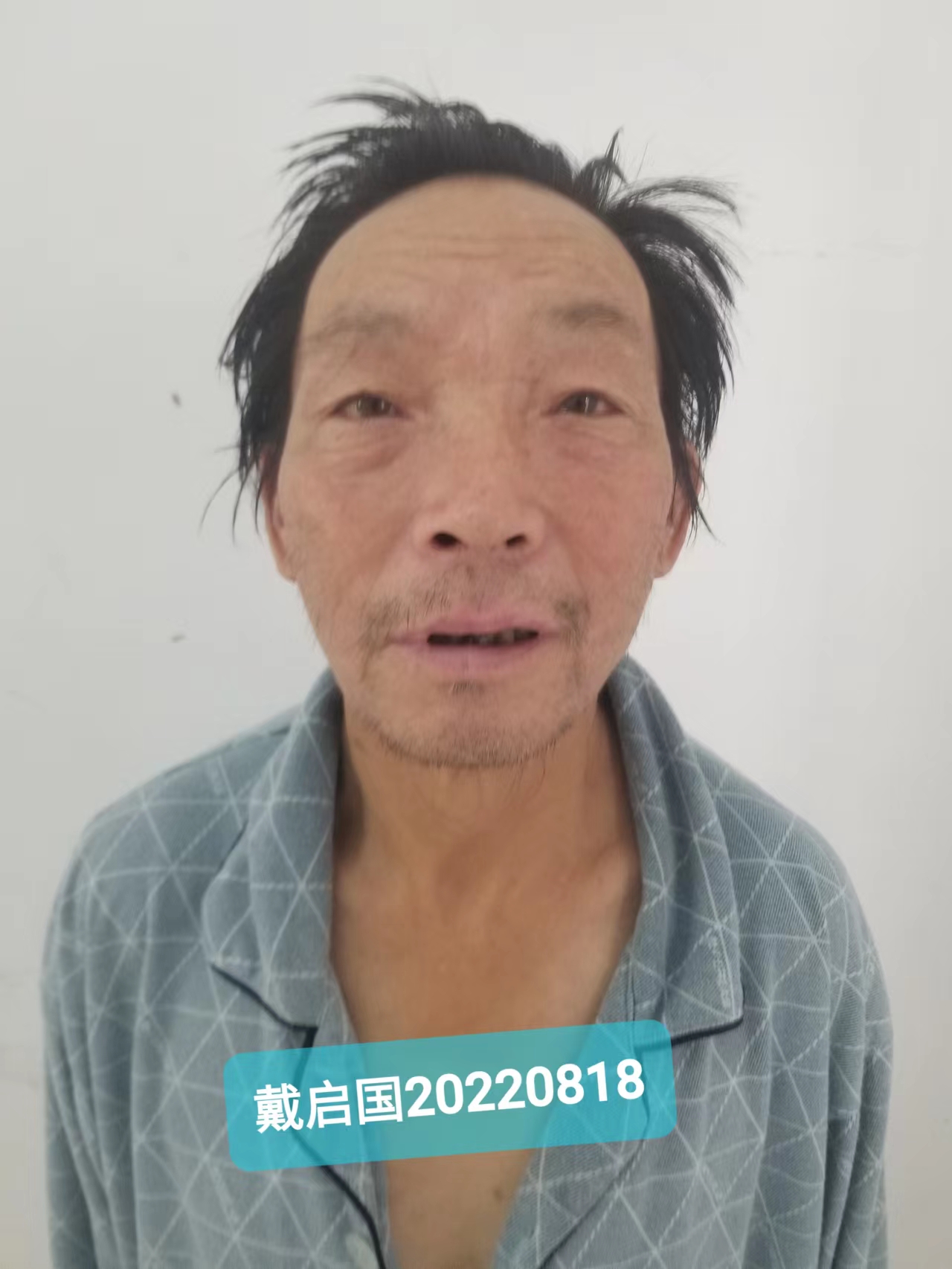 走失者照片 贵阳寻亲！六旬老人被救助，自述叫戴...