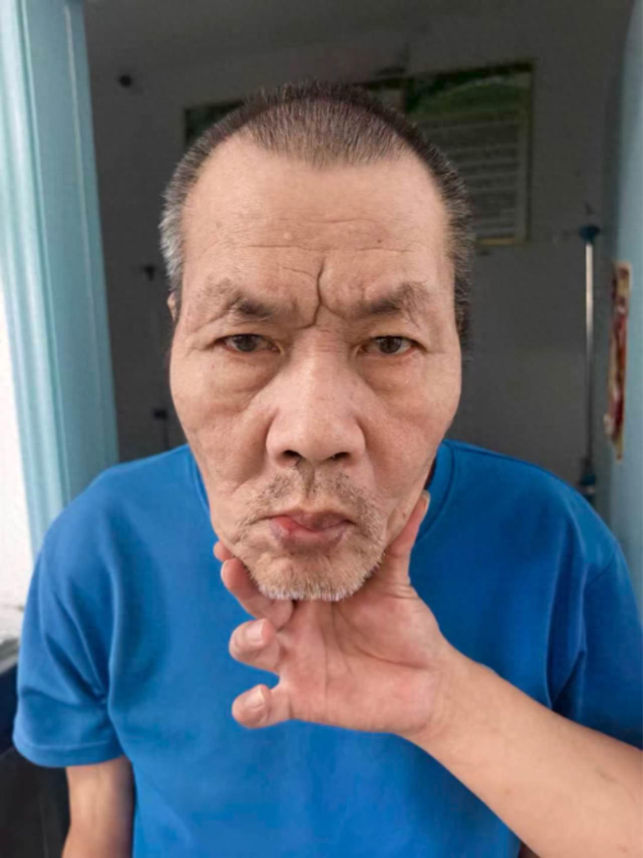 走失者照片 海南省乐东县寻亲：七旬老人被救助，...