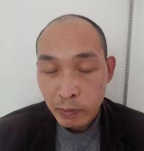 走失者照片 三门峡寻人：中年男子走失，患精神障...