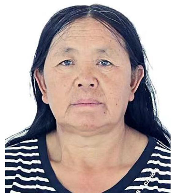走失者照片 保定高碑店寻亲：五旬女子被长期救助