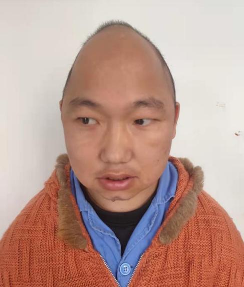 走失者照片 赣州寻亲：青年男子被长期救助，穿黑...