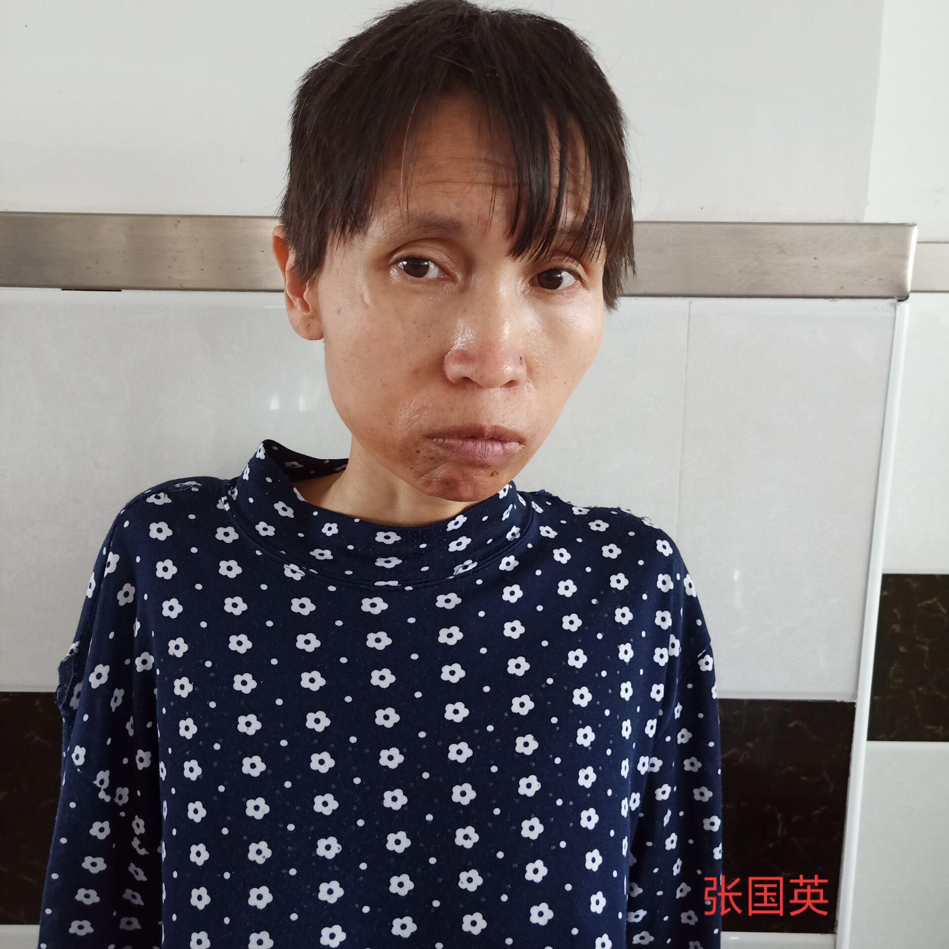 走失者照片 毕节寻亲：五旬女子被救助，蓬头垢面...