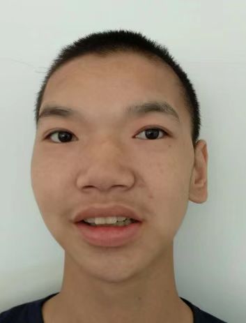 走失者照片 天津寻亲！青年男子被救助多年，自述...