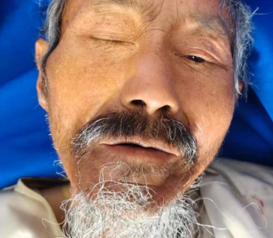 走失者照片 丽江市寻亲：五旬男子被救助，自述叫...