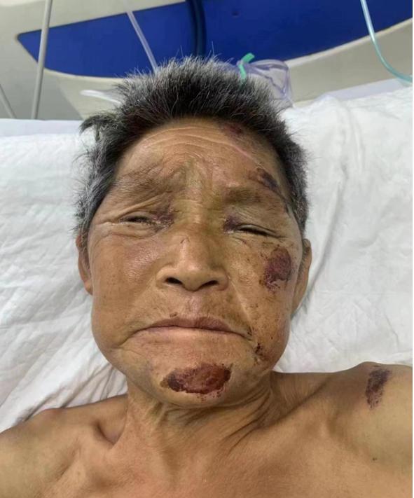 走失者照片 周口寻亲：七旬老太被救助，自述叫徐...