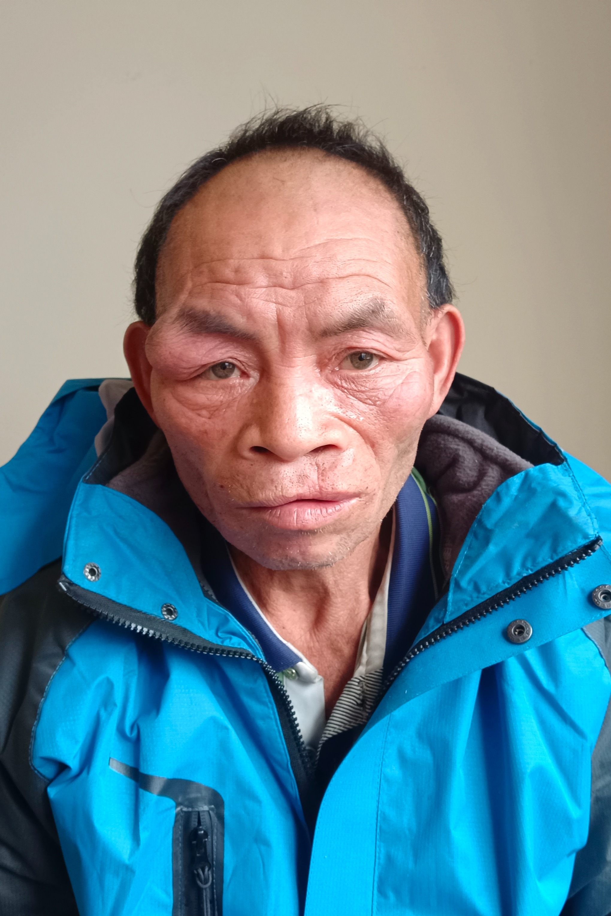 走失者照片 全国救助站