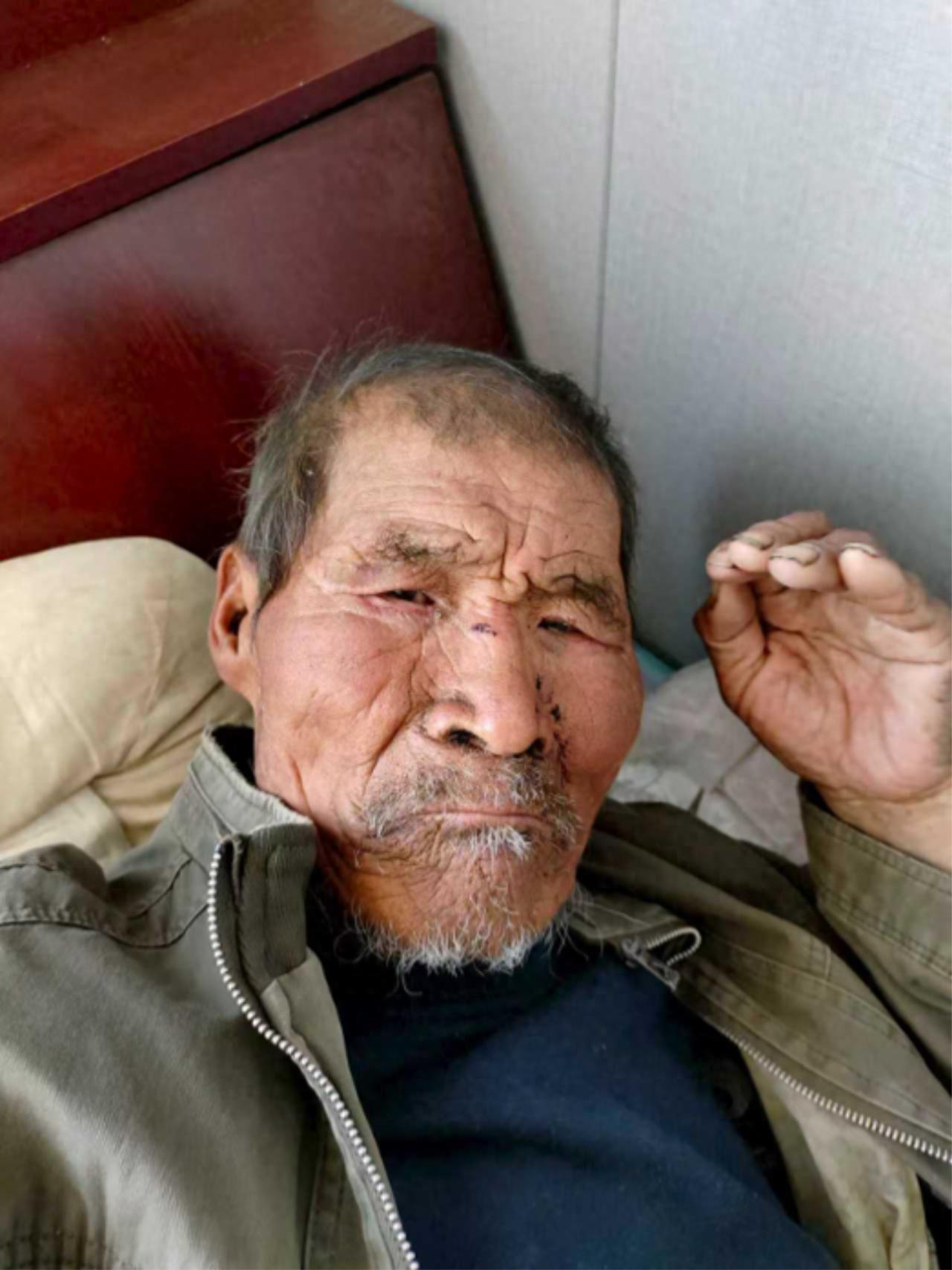 走失者照片 双鸭山市寻亲：六旬老人被救助，自述...