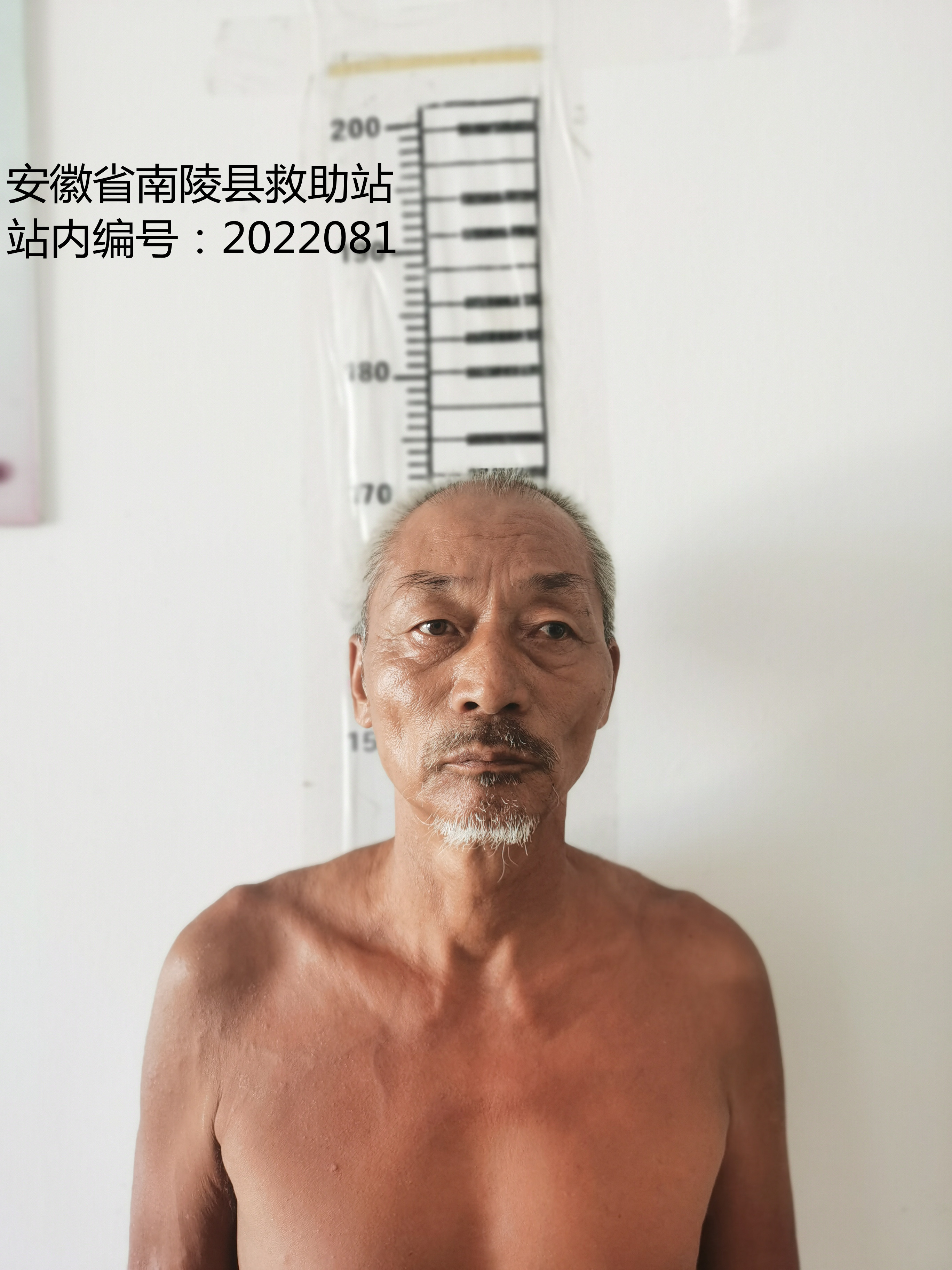 走失者照片 芜湖寻亲：五旬男子被救助，自述叫张...