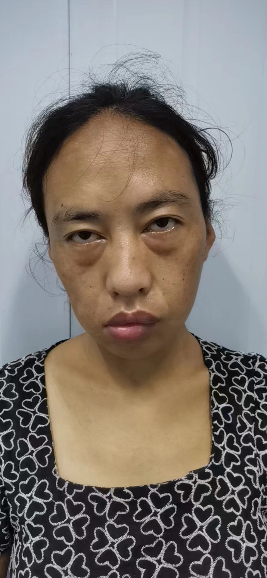 走失者照片 合肥寻亲：青年女子被救助，自述叫王...