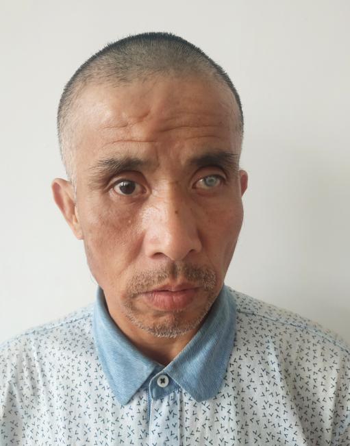 走失者照片 帮他回家！青岛中年男子被救助，左眼...