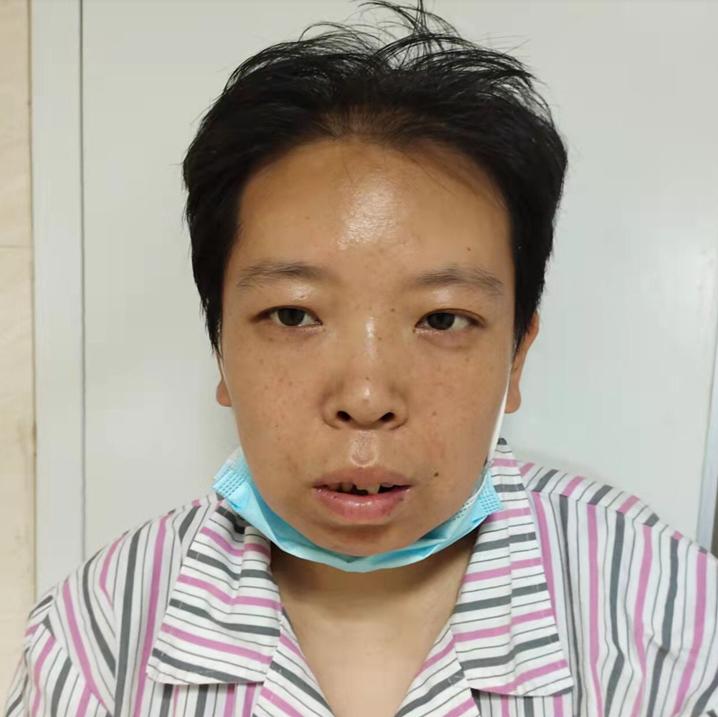 走失者照片 济宁寻亲：青年女子被救助，智力异常