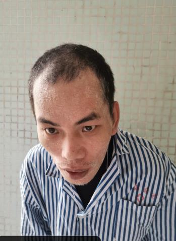 走失者照片 珠海寻亲：青年男子被救助多年，精神...
