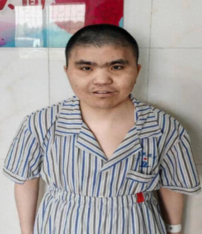 走失者照片 济宁市寻亲：中年男子被救助，高1米...