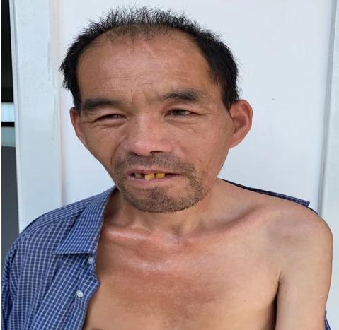 走失者照片 襄阳老河口寻亲：五旬男子被救助，高...