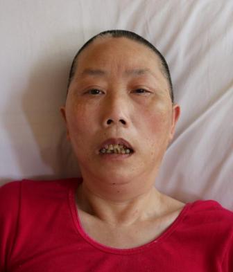 走失者照片 毕节寻亲：五旬女子被救助，自述叫明...