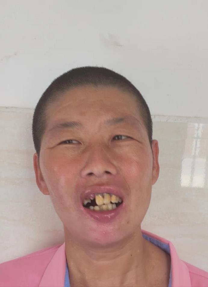 走失者照片 宿州寻亲：中年女子被救助，表述不清...