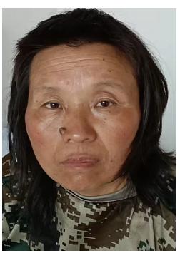 走失者照片 宿州寻亲：六旬老太被救助，高1米6...