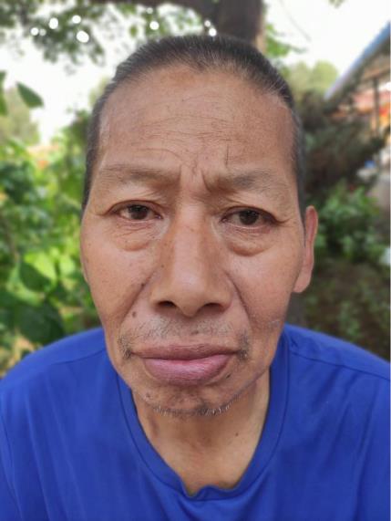 走失者照片 大同寻亲：五旬男子被救助数月，自述...