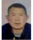 走失者照片 周口急寻：六旬老人走失，患脑部手术...