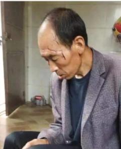 走失者照片 曲靖急寻：五旬男子走失，精神异常，...