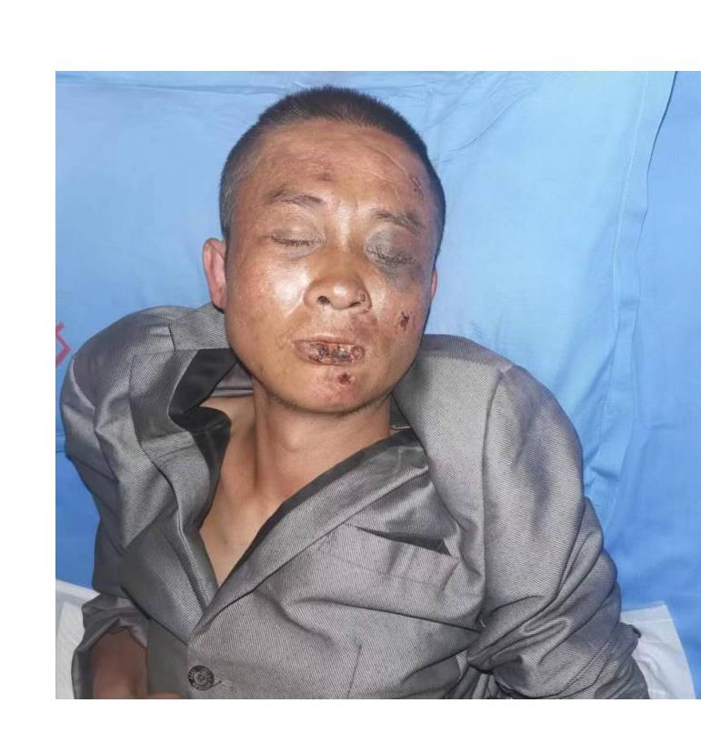 走失者照片 哈尔滨寻亲：中年男子被救助，穿灰色...