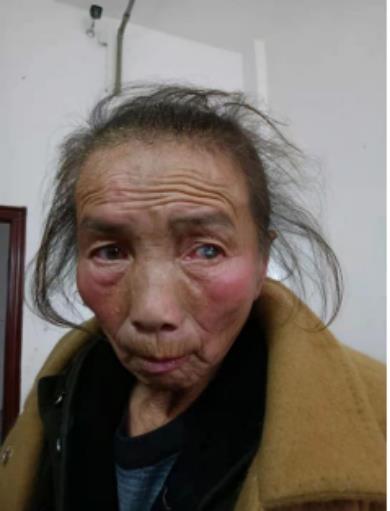 走失者照片 吉安寻亲：五旬女子被救助，高约1米...