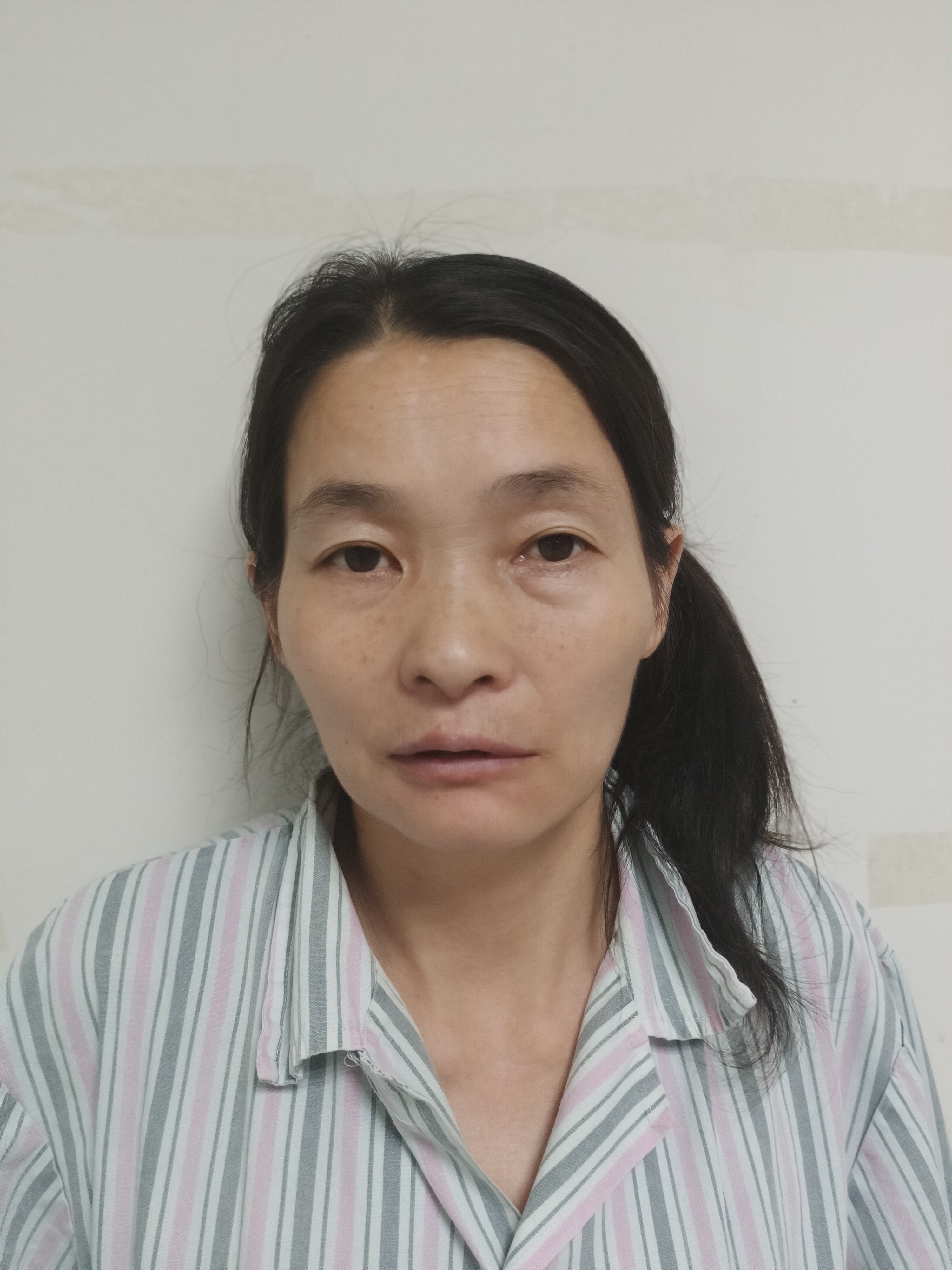 走失者照片 合肥寻亲：中年女子被救助数月，穿格...