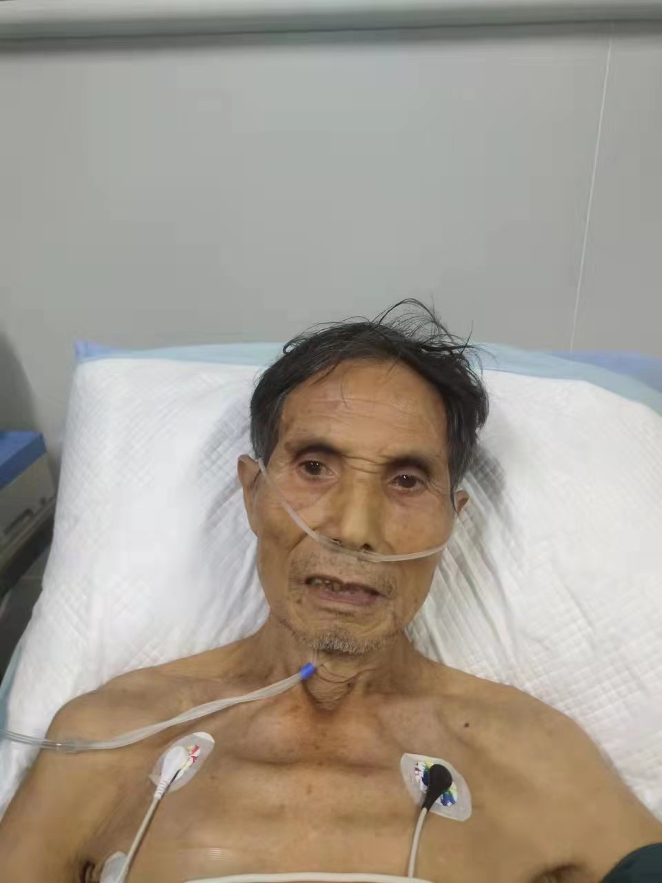 走失者照片 海南东方救助站：七旬老人被救助，自...