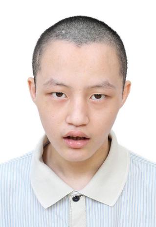 走失者照片 柳州寻亲：青年男子在佛山被长期救助...