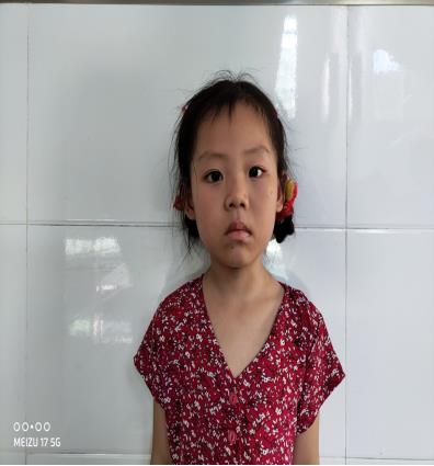 走失者照片 寻亲：5岁女孩在金华义乌被救助多年...