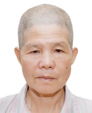 走失者照片 佛山寻亲：中年女子被救助多年，偏瘦...