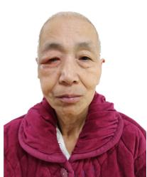走失者照片 驻马店寻亲：六旬老太被救助，高1米...
