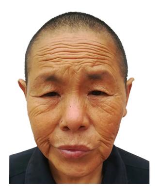 走失者照片 驻马店寻亲：六旬老太被救助，高1米...