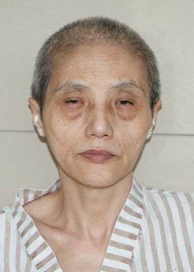 走失者照片 杭州寻亲：六旬老太被救助，患精神分...