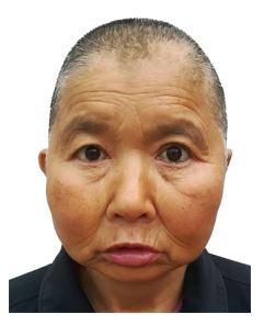 走失者照片 驻马店寻亲：六旬老人被救助，高1米...