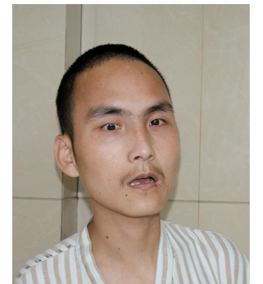 走失者照片 杭州寻亲：青年男子被救助，精神发育...
