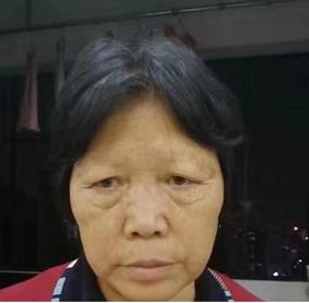 走失者照片 南宁急寻：六旬老太走失，患脑萎缩，...
